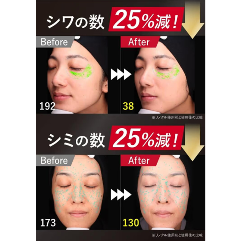 シワ・シミを徹底的にカバー