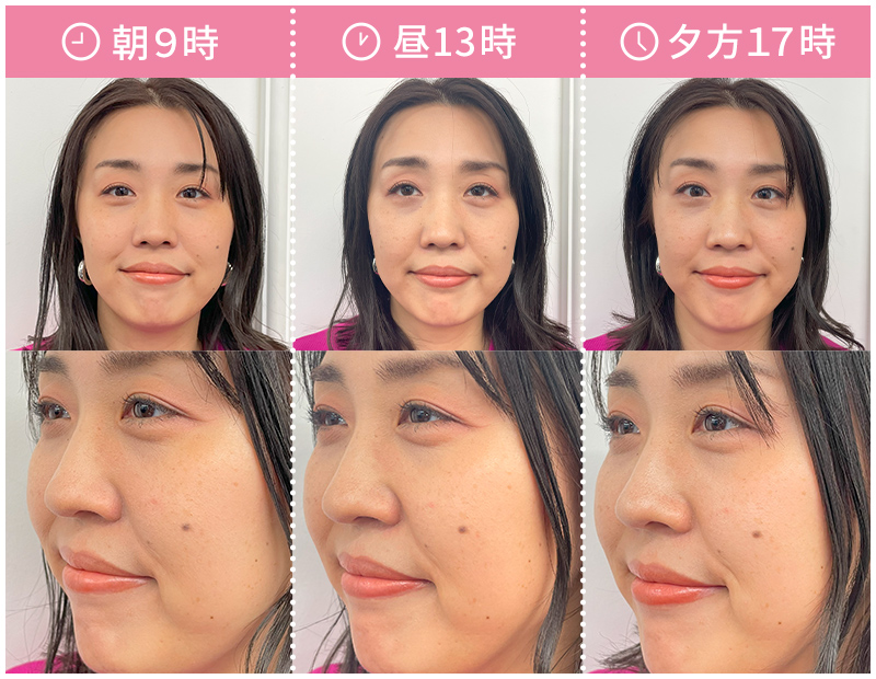 簡単操作でピンポイントにケア！